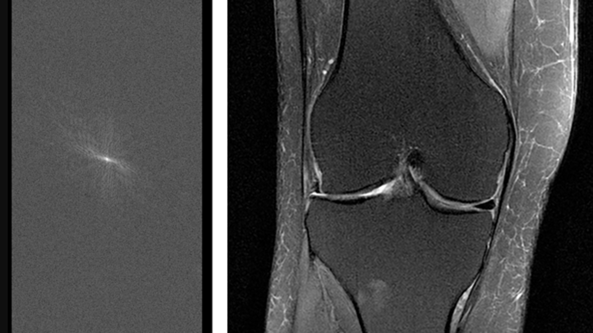 New fastMRI open source AI research tools from Facebook and NYU School of Medicine on engineering.fb.com, Facebook's Engineering blog